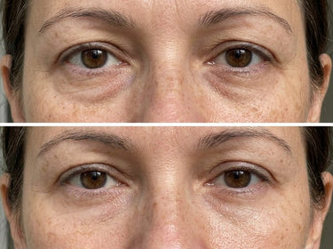 Kristen's eyes before and after the mask